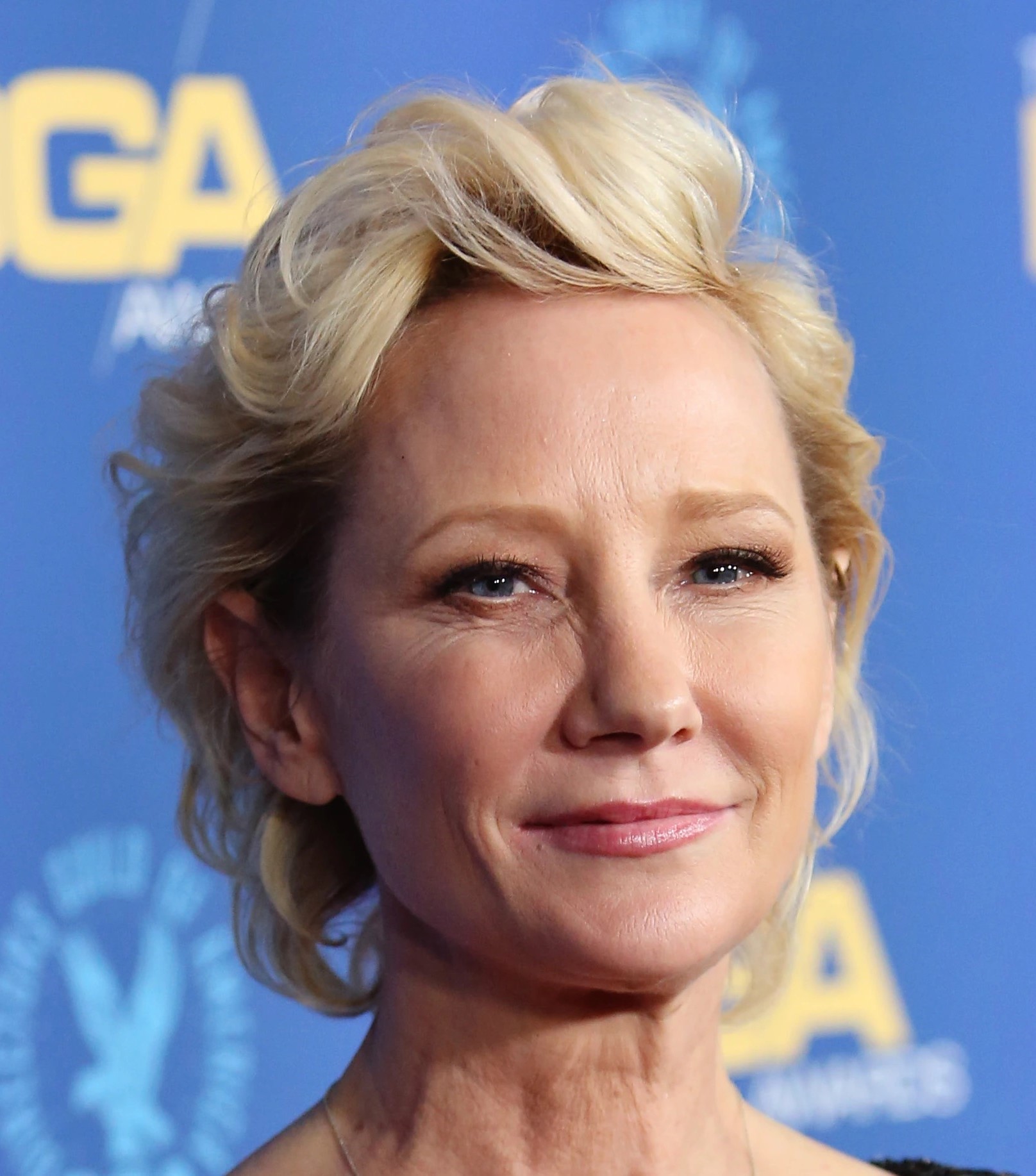 Is Anne Heche And James Tupper Married? Actress Met An Accident, Know About Couple And Their Kids